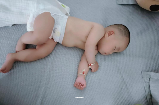 新沂六个月宝宝眼睛散光